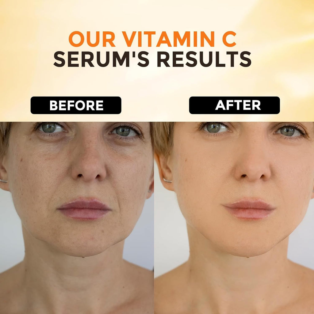 +1Herolabs Face Serum Set – Vitamin C Serum & Hyaluronic Acid Serum for Face – Anti Aging Serum Skin Care Set for Women – Serum for Firm, Wrinkle Smoothing, Dark Spot Corrector, Brighten Dullness